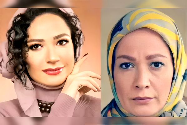 تغییر باورنکردنی چهره فهیمه «پایتخت» با تزریق ژل و اکستنشن مژه